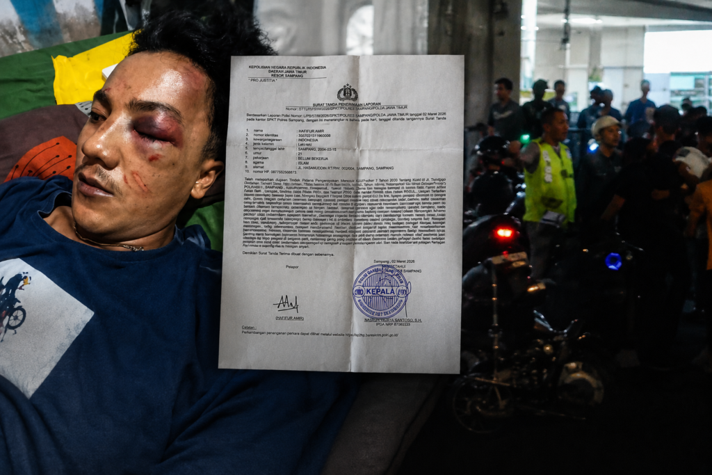 3 Bulan Sejak Laporan Dibuat, Korban Dugaan Pengeroyokan di Sampang Belum Terima SP2HP Terbaru